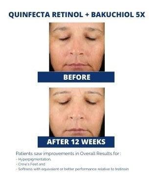 QUINFECTA RETINOL + BAKUCHIOL 5X - ADM Skin