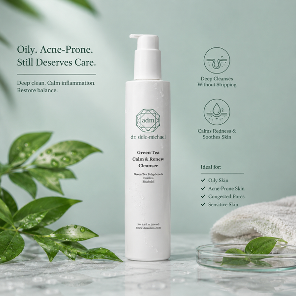 Oily Acne-Prone Skin Cleanser: The First Step to Controlling Excess Oil