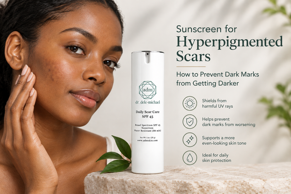 Sunscreen for Hyperpigmented Scars: How to Prevent Dark Marks from Getting Darker