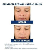 QUINFECTA RETINOL + BAKUCHIOL 5X - ADM Skin